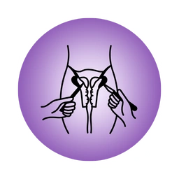 Hysteroscopy